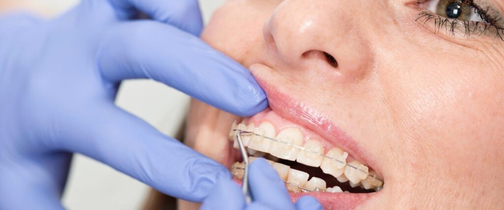 ortodonzia dental turk albania