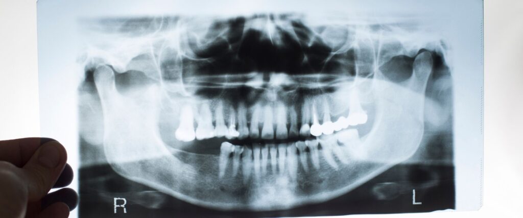 parodontologia dental turk albania